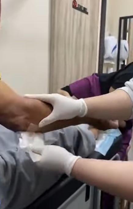 Wound treatment video